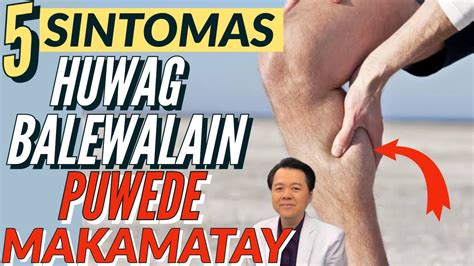 5 Sintomas Na Huwag Balewalain Pwede Maka Matay By Doc Willie Ong