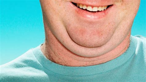 Say Goodbye To Your Double Chin Effective Strategies For A More