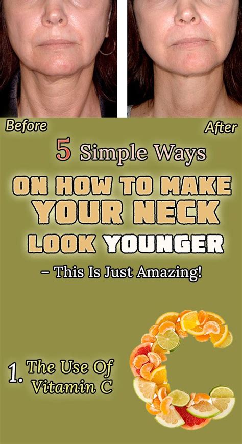 5 Simple Ways On How To Make Your Neck Look Younger This Is Just