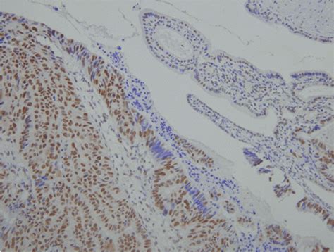 Staining For Cyclooxygenase Cox And The Cytoplasmic And Nuclear