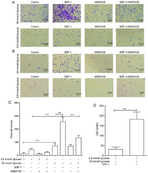 Effect Of High Glucose And Amd On Migration And Invasion Ability Of