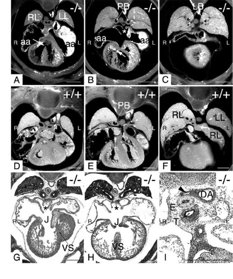 Cited Null Embryos Show A Range Of Pulmonary And Cardiac Defects Two