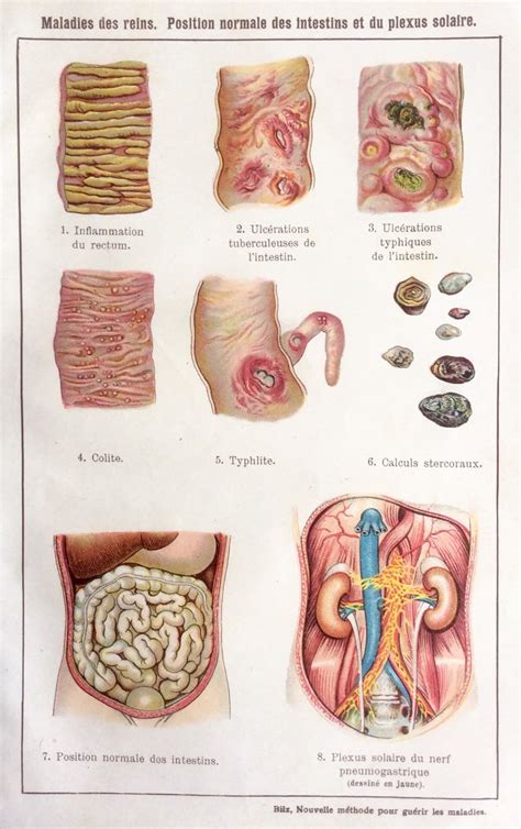 Antique Print French Anatomy Bookplate 1900s INTESTINES DISSECTION