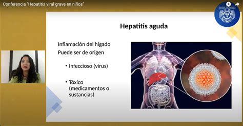 Dolor Abdominal Diarrea Y V Mito Preceden Casos De Hepatitis Aguda