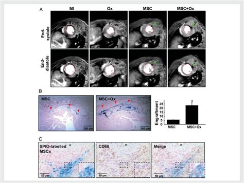 Tracking Of MSC Engraftment In The Infarct Heart MSCs Pre Labelled