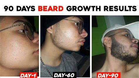 90 Days Beard Growth Results Man Matters Beard Oil Man Matters