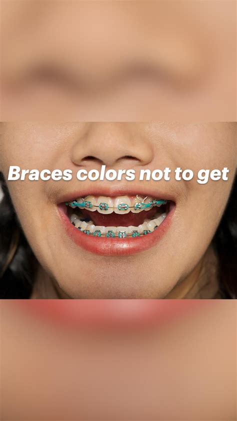 Best Braces Colors Maroon Before And After Braces Braceson Bracescolors Artofit