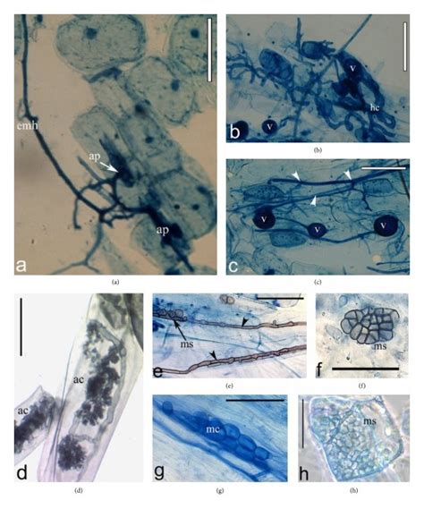 Arbuscular Mycorrhizal AM Ad And Dark Septate Endophyte DSE