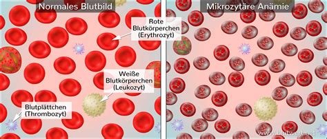 Blutwert Mcv Mittleres Erythrozyteneinzelvolumen Normalwerte