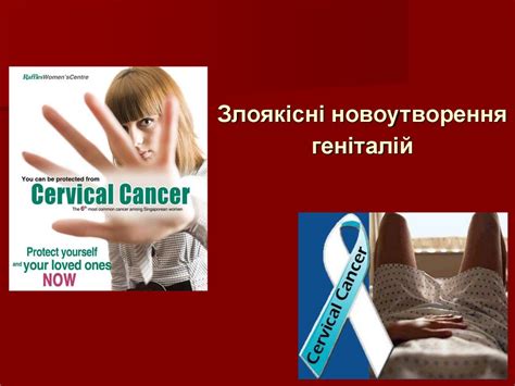 Злоякісні новоутворення геніталій. Рак зовнішніх статевих органів ...