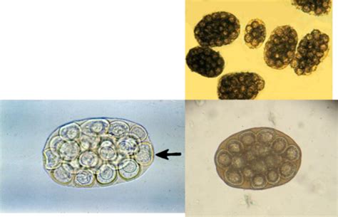 Trematodes And Cestodes Flashcards Quizlet