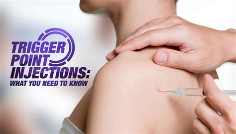 Trigger Point Injections What You Need To Know Kennedy Health Clinic