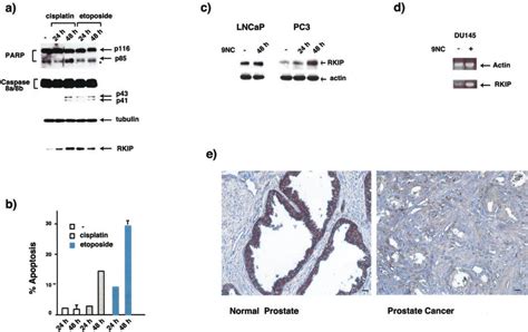 Expression Of RKIP In Prostate Cancer Cells And Primary Prostate