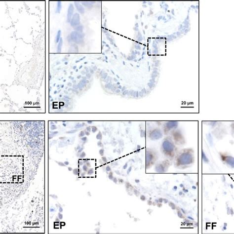 BMP1 expression is increased in human IPF lungs. Representative images ...