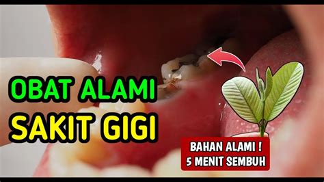 Obat Sakit Gigi Paling Ampuh Cara Mengobati Sakit Gigi Youtube