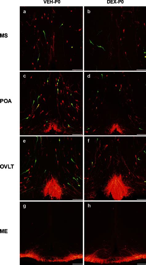 IF GnRH And TG GnRH Neurons On Coronal Sections Of Maternally Vehicle