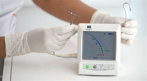 Como O Localizador Apical Melhora A Efici Ncia Dos Canais Radiculares