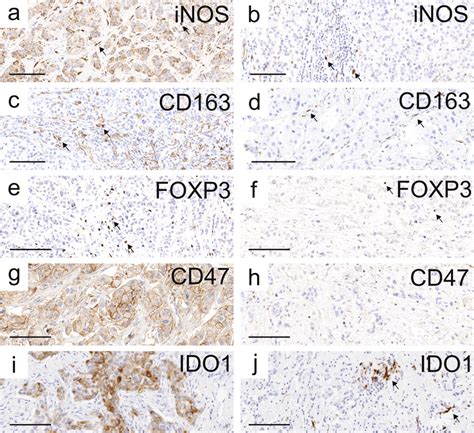 Representative Examples Of Inos Cd163 Foxp3 Cd47 And Ido1 Download Scientific Diagram