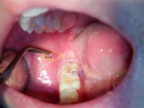 案例分享 俊美牙醫診所 Chunmei Dental Clinic