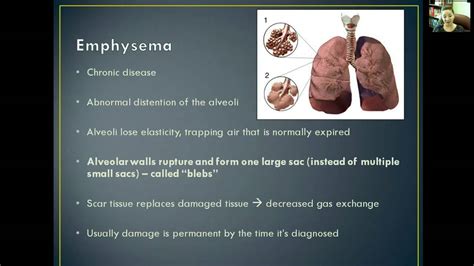 Respiratory Chronic Bronchitis And Emphysema Youtube