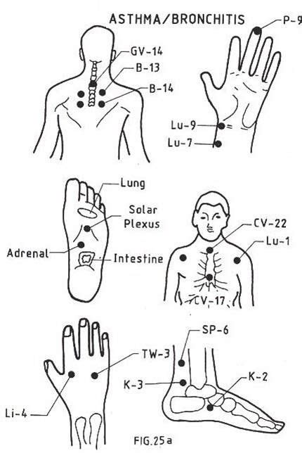 55 Best Hijama Points Images Hijama Points Cupping Therapy Cupping Points