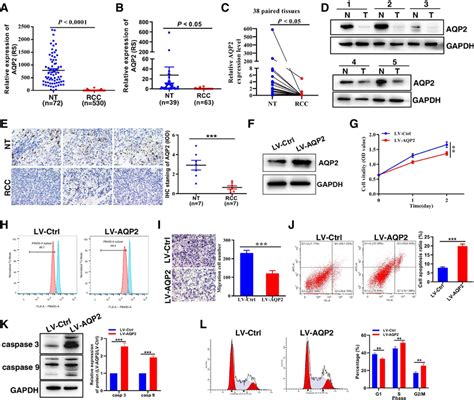 Aqp Is Downregulated In Rcc Tissue And Inbihits Rcc Cell Proliferation