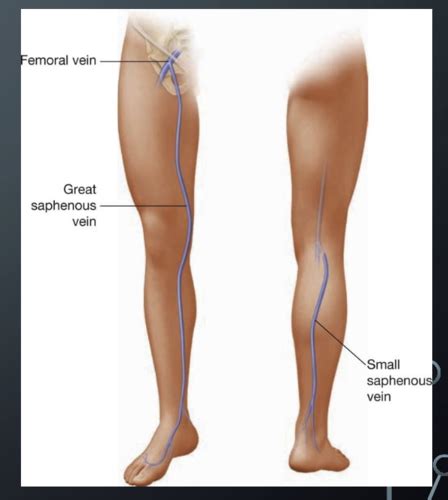 Peripheral Vascular Flashcards Quizlet