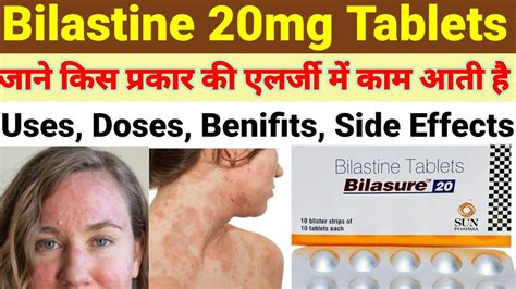 Bilastine Tablet 🤧 Bilastine 20 Mg Bilastine Tablets 20 Mg Usesdose