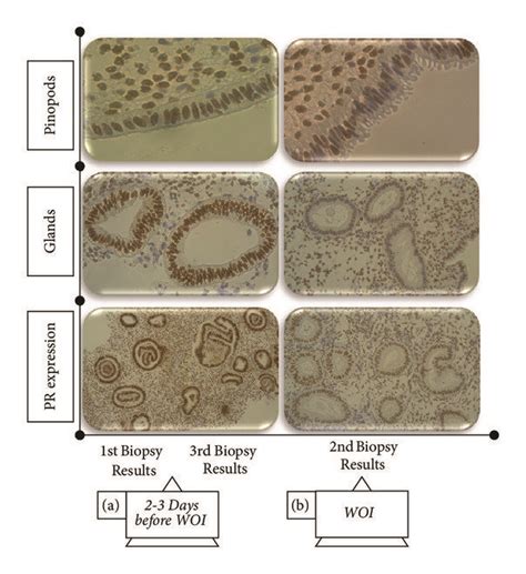 Endometrial Cycle Dating Based On Noyes Et Al S Criteria And