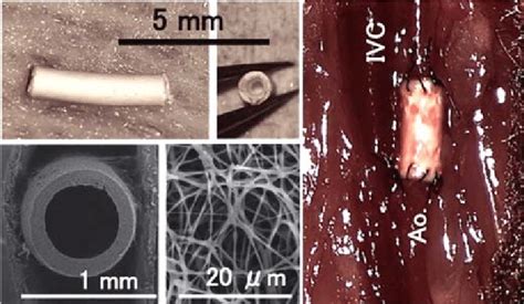 A Structure Of Tissue Engineered Vascular Graft TEVG Implanted