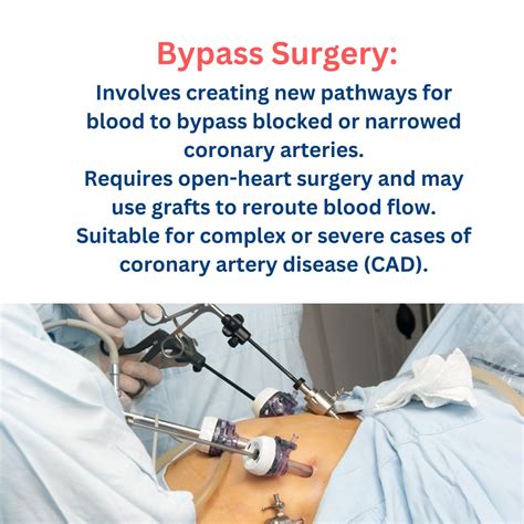 Ppt Bypass Surgery Vs Angioplasty Powerpoint Presentation Free