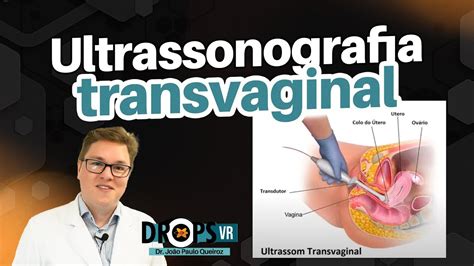 ULTRASSONOGRAFIA TRANSVAGINAL DETALHES TÉCNICOS DE COMO REALIZAR O