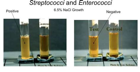 Salt Tolerance Test For Enterococcus Species • Microbe Online