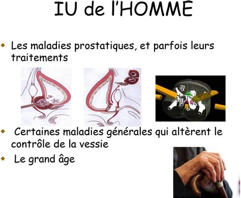 Traitement De L Incontinence Urinaire Dr B Pogu Urologue Fmc Sud Marne