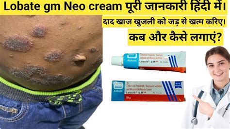 Lobate gm neo cream in hindi जनए लगन क सह तरक हद म