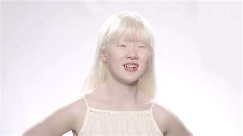 Born with Albinism (2021)