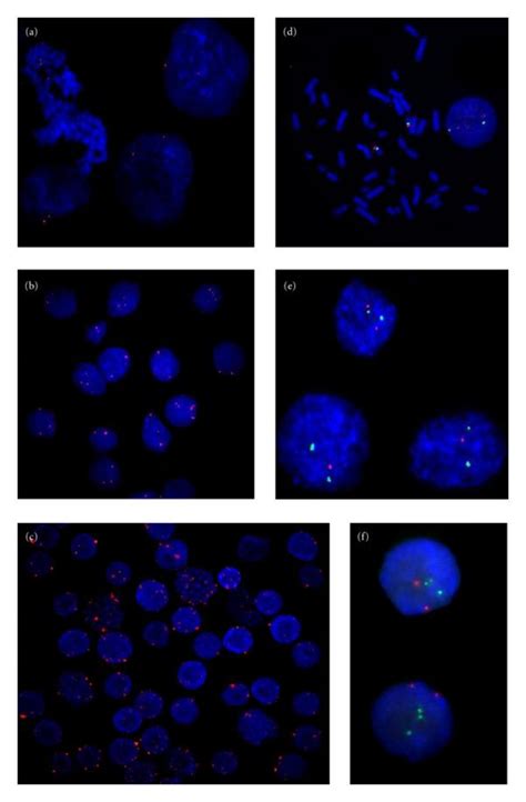 Fluorescence In Situ Hybridization Assay A Interphase Nuclei