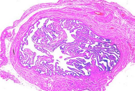 Oviduct At Low Power Collection Of Histology Images