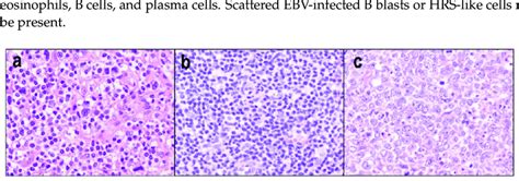 Cytological Spectrum Of Peripheral T Cell Lymphoma Nos A Download Scientific Diagram