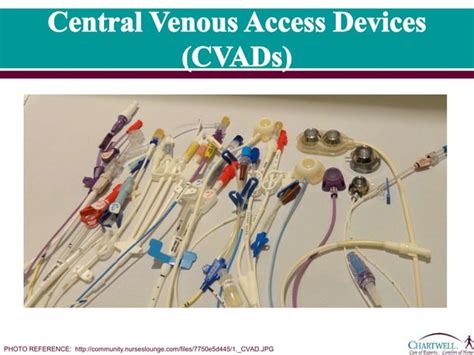 2 Central Venous Access Devices Cvads Ppt