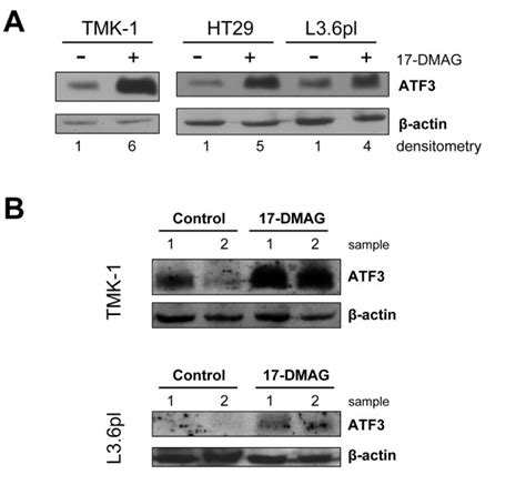 Induction Of ATF3 By Hsp90 Inhibition In Colon Cancer In Vitro And In