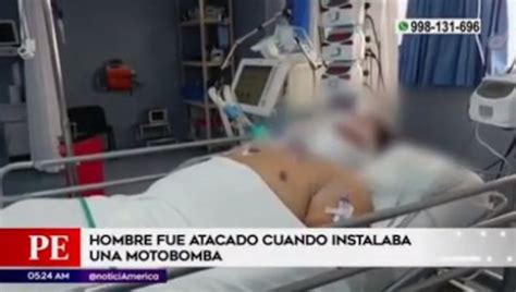 Callao Hombre Resulta Grave Tras Ser Acuchillado En La Cara Y El