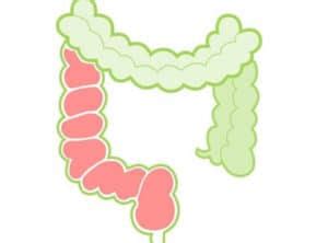 Qué es la obstrucción intestinal Síntomas causas y cómo tratar la