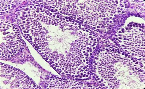 Paraffin Section From Mice Testis Fixed With 10 Formalin Stained With