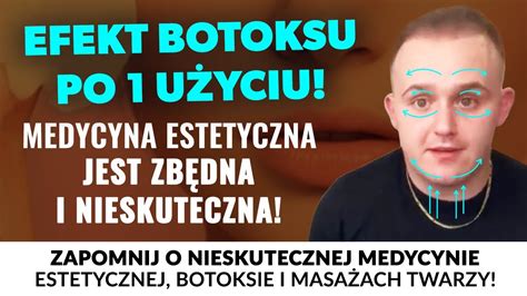 Rossmann Efekt Po U Yciu Zapomnisz O Botoksie Medycynie