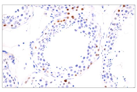 Sall4 6e3 Mouse Mab Cell Signaling Technology