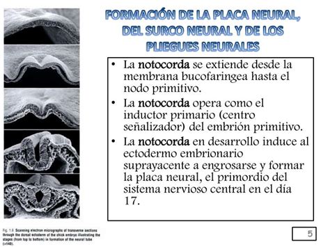 Ppt Embriolog A Del Sistema Nervioso Powerpoint Presentation Id