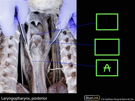 Anatomy Lab Pharynx Larynx Trachea Flashcards Quizlet