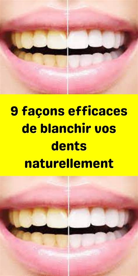 Blanchir Les Dents Naturellement Artofit