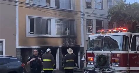 Victims Suffers Smoke Inhalation From Garage Fire In San Franciscos Bernal Heights Cbs San